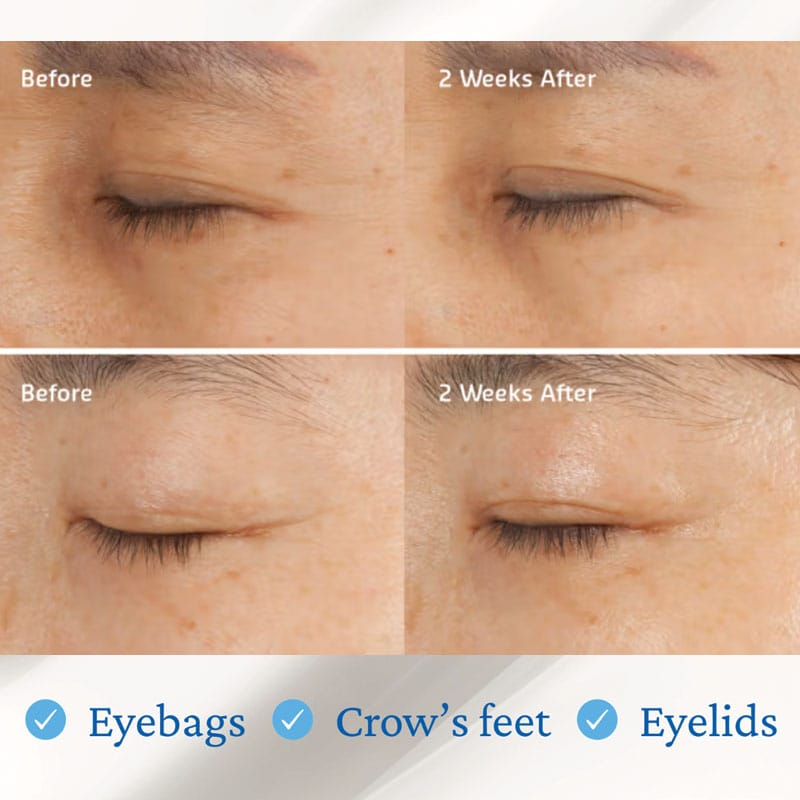 belif Moisturizing Eye Bomb 25ml – Augencreme mit Peptiden, Bakuchiol & Koffein gegen Falten & Augenringe. Bild mit Claim provides firmness targeting 3 areas, eyebags, crows feet, eyelids