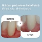 edel+white Sonic Generation Health Suite Schallzahnbürste – Putzleistung Sehr gut. Sichtbar gesünderes Zahnfleisch bereits nach einem Monat. Empfohlen von Schweizer Dentalprofis.